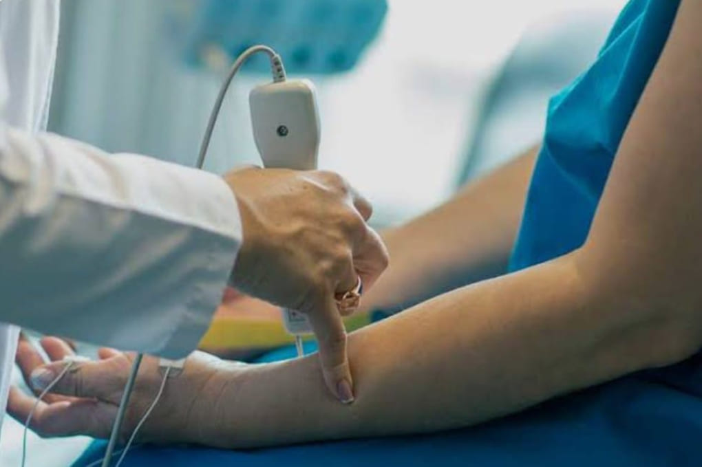 Velocidades de neuroconducción